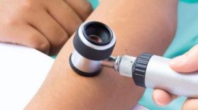 Dermatologi i Kollund, Fredericia og Esbjerg